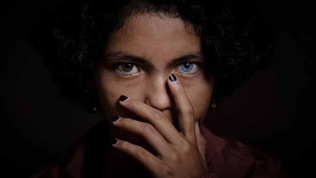 Heterochromia Iridis